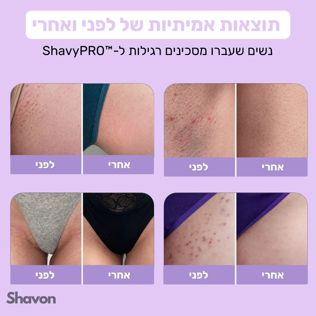 ™ShavyPRO - סכין הגילוח האחרונה שלך